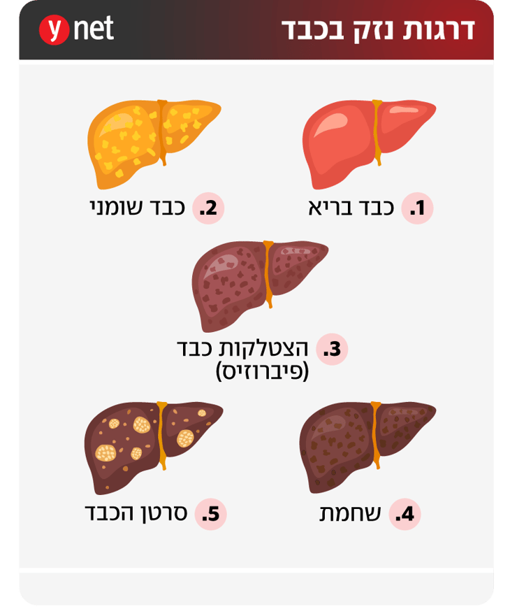 אינפו כבד שומני