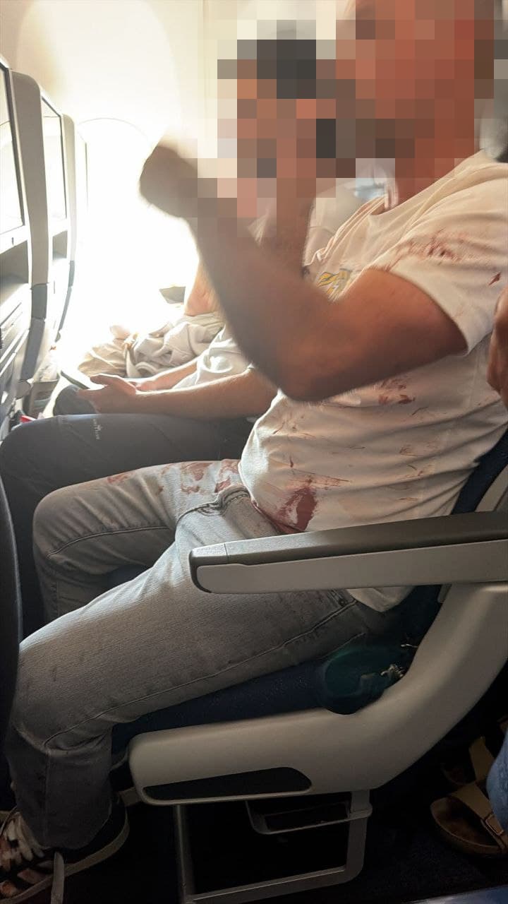 תיעוד נוסעים שניסו להפריד בין הטייסים