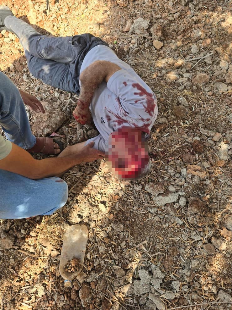  פלסטיני נפצע לאחר שהותקף באלימות קשה על-ידי מתנחלים בכפר אוסרן, דרומית לשכם.