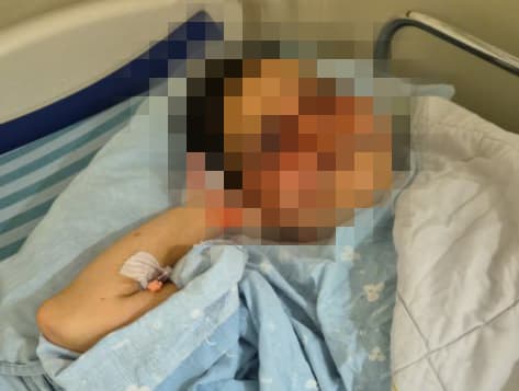 האישה שהותקפה בכפר סבא האישה שהותקפה בכפר סבא