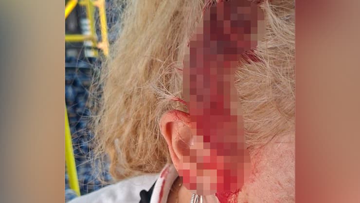 הפקחית שהותקפה פקחית חברת התחבורה הציבורית אקסטרה הותקפה באלימות במהלך ביקורת שגרתית באוטובוס בנתניה