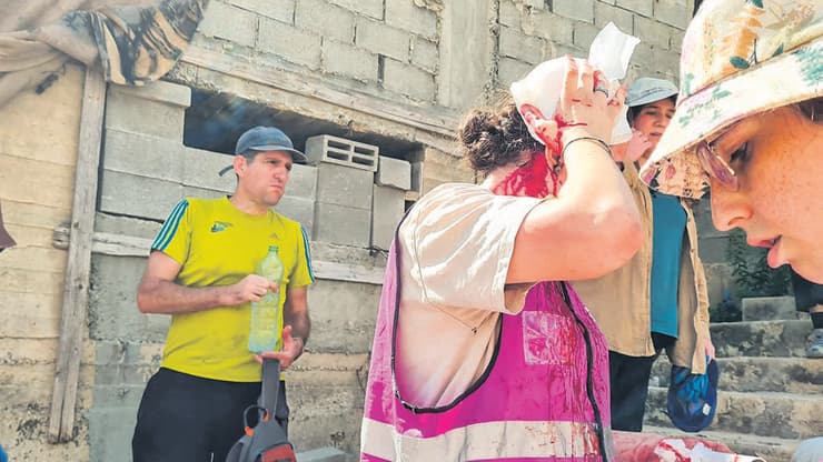 אקטיביסטית של "קול רבני לזכויות אדם" שהותקפה על ידי יהודים (צילום: ליאורה בינימין) אקטיביסטית של "קול רבני לזכויות אדם" שהותקפה על ידי יהודים