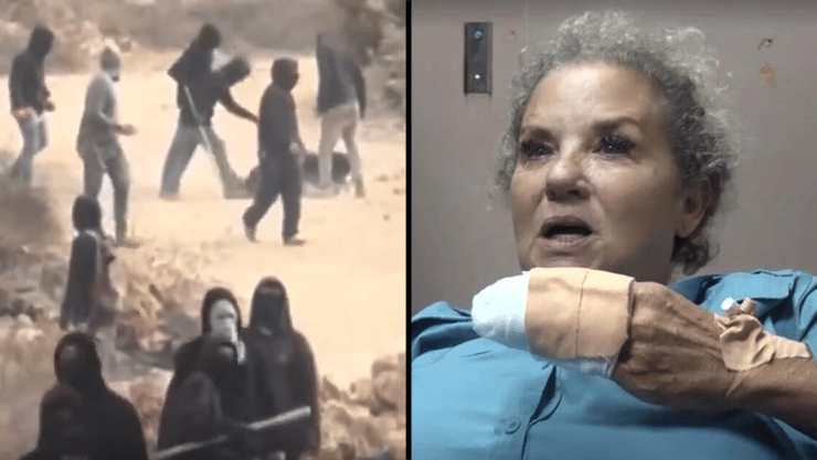 היידי לוין בבית החולים; משמאל: מתנחלים רעולי פנים מכים את לוין בשטח הכפר אבו פלאח (צילום: רויטרס) חצי חצאים היידי לוין