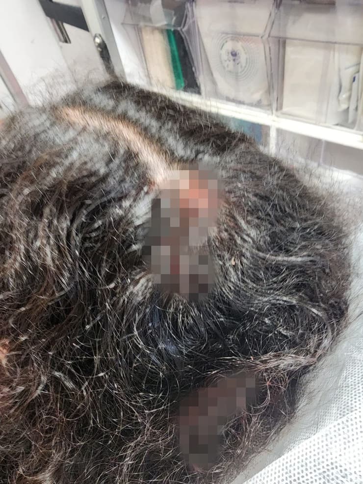 נערה הותקפה באוטובוס על ידי מספר נערות מבית ספרה