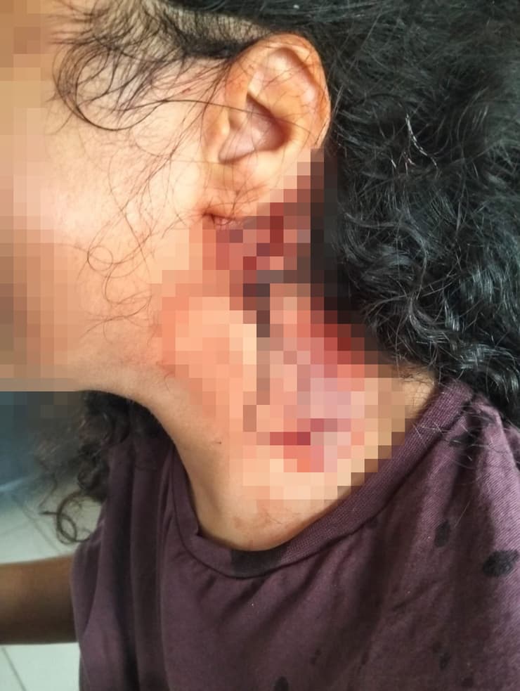 נערה הותקפה באוטובוס על ידי מספר נערות מבית ספרה