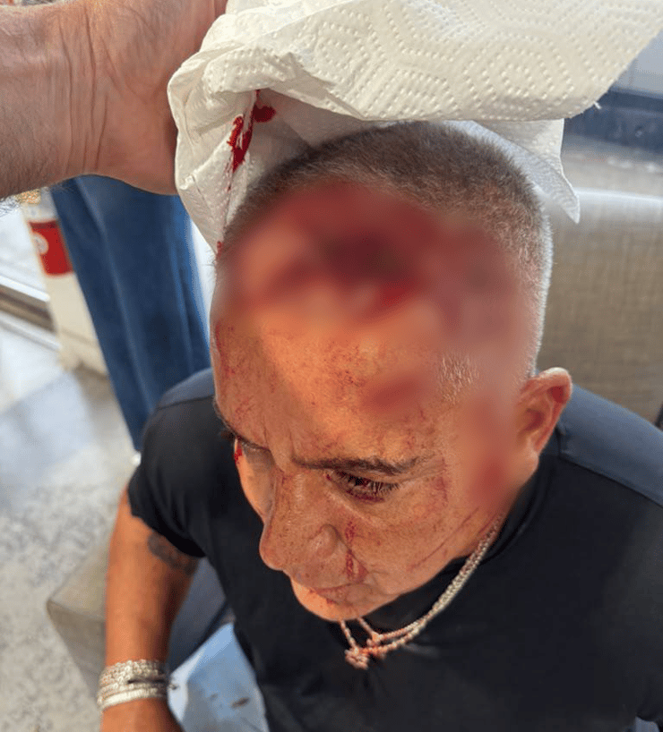 רונן אחרי התקיפה איש עסקים לוס אנג'לס רונן ורד תקיפה אקדח