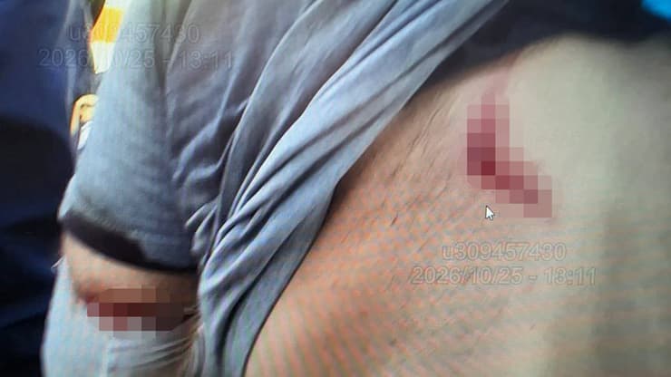 צילום: דוברות המשטרה שליח "וולט" הותקף בסביון