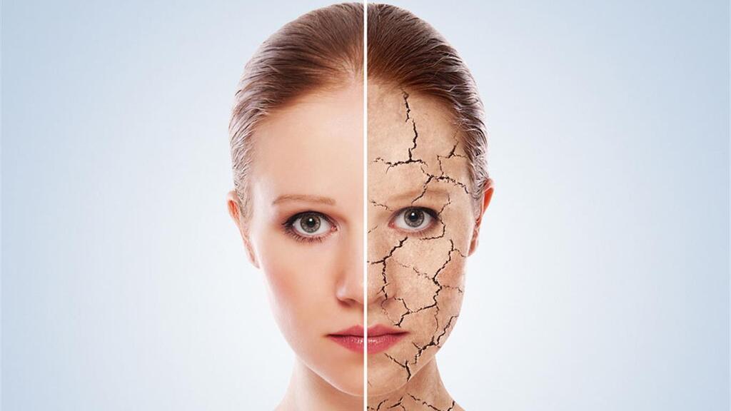 Skin dryness is directly linked to various skin conditions 