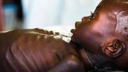 תינוק שסובל מתת-תזונה בדרום סודן                