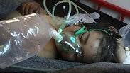 ילד סורי שנפגע מנשק כימי