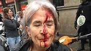 אישה שהוכתה על ידי שוטרים בברצלונה              