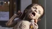 תינוקת בת חודש שמתה בע'וטה בעקבות תת-תזונה חריפה