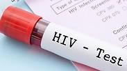 איידס HIV מעבדה בדיקת דם