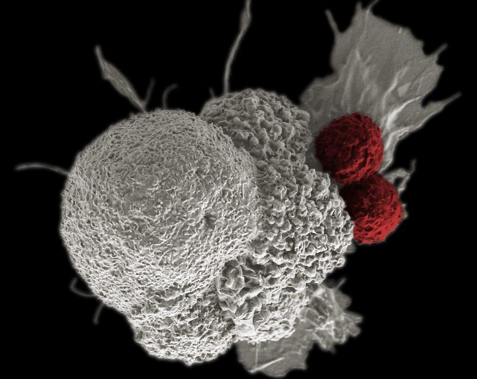 Cancerous tumor attacked by two T cells 