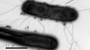נגיפים (נראים בתמונה כעיגולים קטנים) תוקפים חיידקים