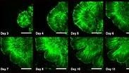 11 ימים במעבדה: התפתחות אורגנואיד המוח והופעת הקפלים החל בשבוע השני 