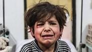 ילד סורי פצוע במזרח רוטה              