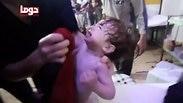 ילד פצוע בסוריה