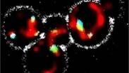 תמונת מיקרוסקופ של תאי שמר. אברוני המיטוכונדריה (מסומנים באדום) מחוברים לפרוקסיזומים (בתכלת) באמצעות "רצועות" זעירות (בירוק)