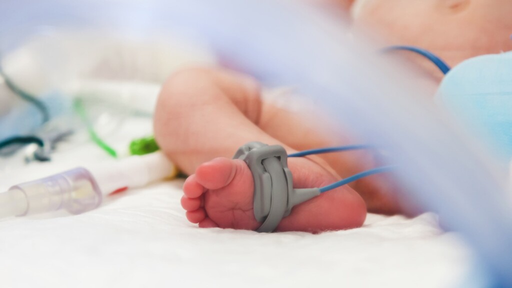 Младенец в реанимации (Фото: shutterstock) טיפול נמרץ תינוק