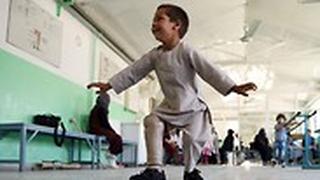 אחמד ילד מ אפגניסטן רוקד עם רגל תותבת