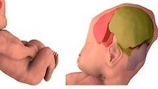 כך משתנה הראש של התינוק