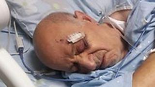 תקיפה פתח תקווה יוסף נגר נהג מונית בן 78 הותקף אישפוז פצועה