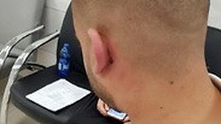 מוחמד אבופנה בן 27 וחוסאם מסארוה בן 21 תושבי כפר קרע הותקפו על ידי חרדים