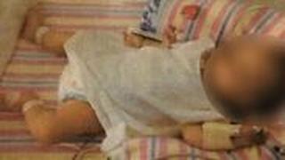 ילדה תינוקת ש הורעבה ב דיאטה טבעונית טבעונים סידני אוסטרליה