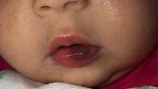 התינוקת שהותקפה במעון בשכונת נווה שאנן בחיפה