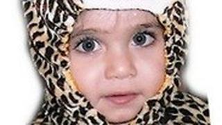 רביד סולם, ילדה שנכוותה בכל גופה, ובני משפחתה