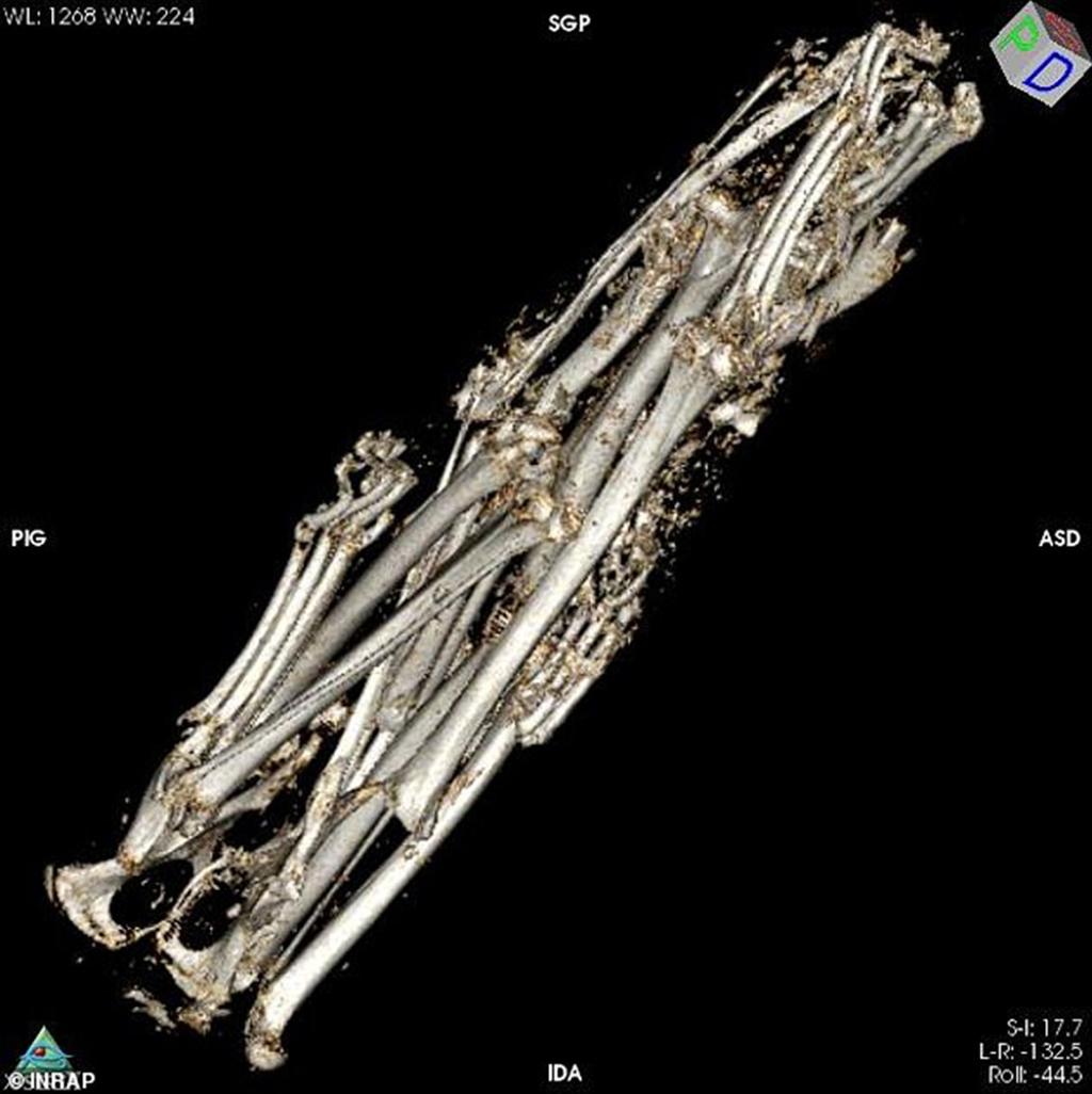 Компьютерная реконструкция костей, обнаруженных внутри мумии 