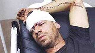 מוהנד קוואריק אשר נפצע מאבן שנזרקה עליו מרכב בעל לוחית ישראלית