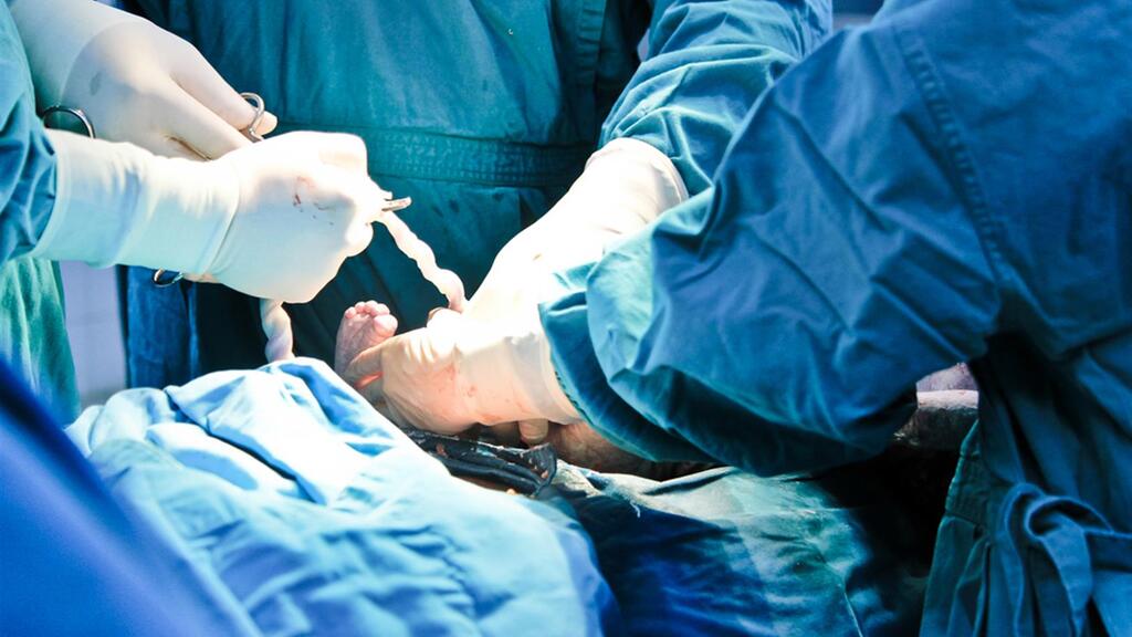 Фото: shutterstock ניתוח קיסרי