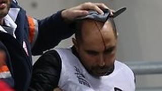 הצלם שנפגע מקבל טיפול