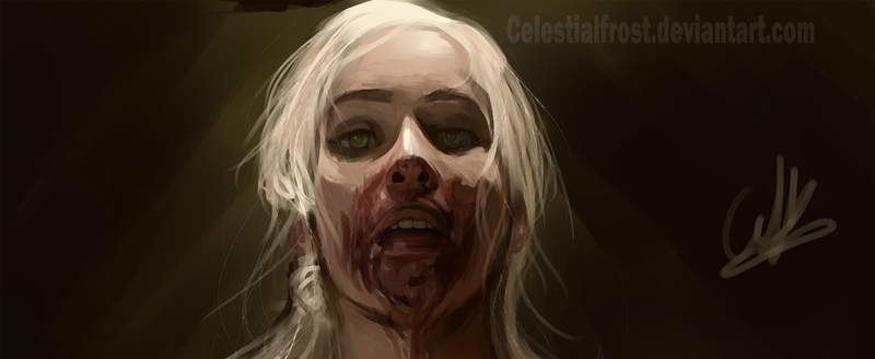 כיתוב לבדיקה