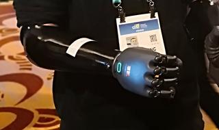 הפרוטזה הרובוטית של BrainCo