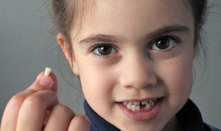 שיניים ילדים ילדה שיני חלב