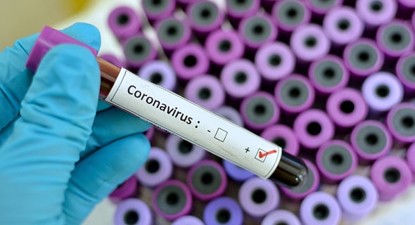 Coronavirus test (illustration)