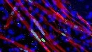 תמונת מיקרוסקופ - תאי שריר על מצע תלת מימדי יוצרים רקמת שריר