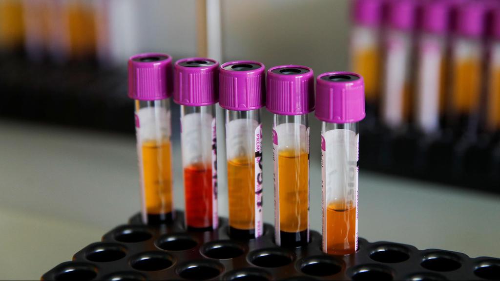Coronavirus testing lab (Photo: Reuters) Coronavirus testing lab