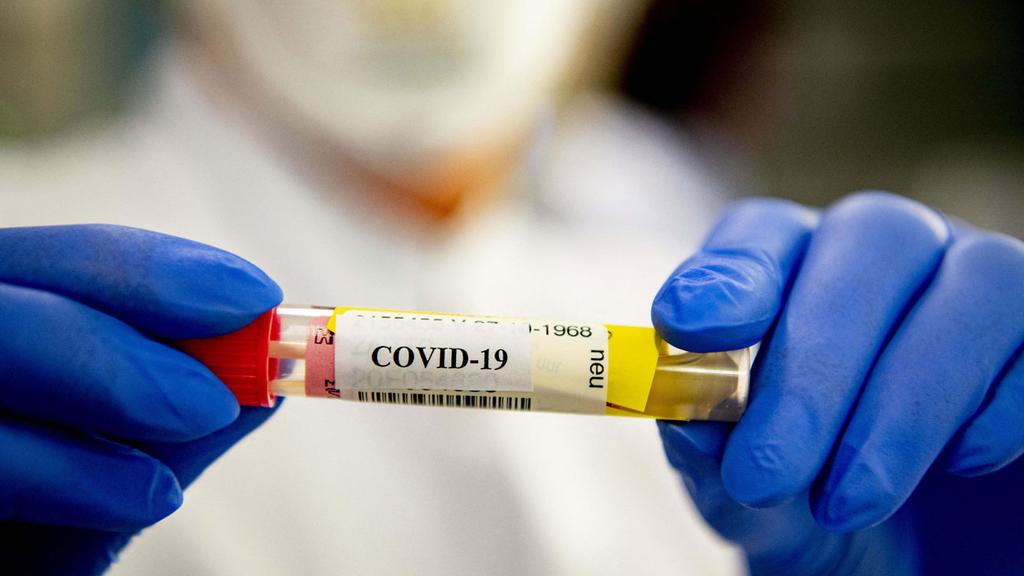 Анализ на коронавирус. Фото: МСТ 