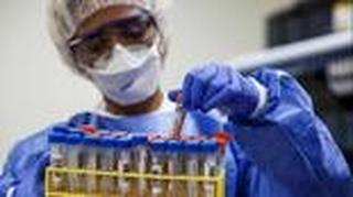 בדיקת קורונה בדיקה קופת חולים מכבי רחובות