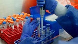 בדיקת קורונה בדיקה קופת חולים מכבי רחובות