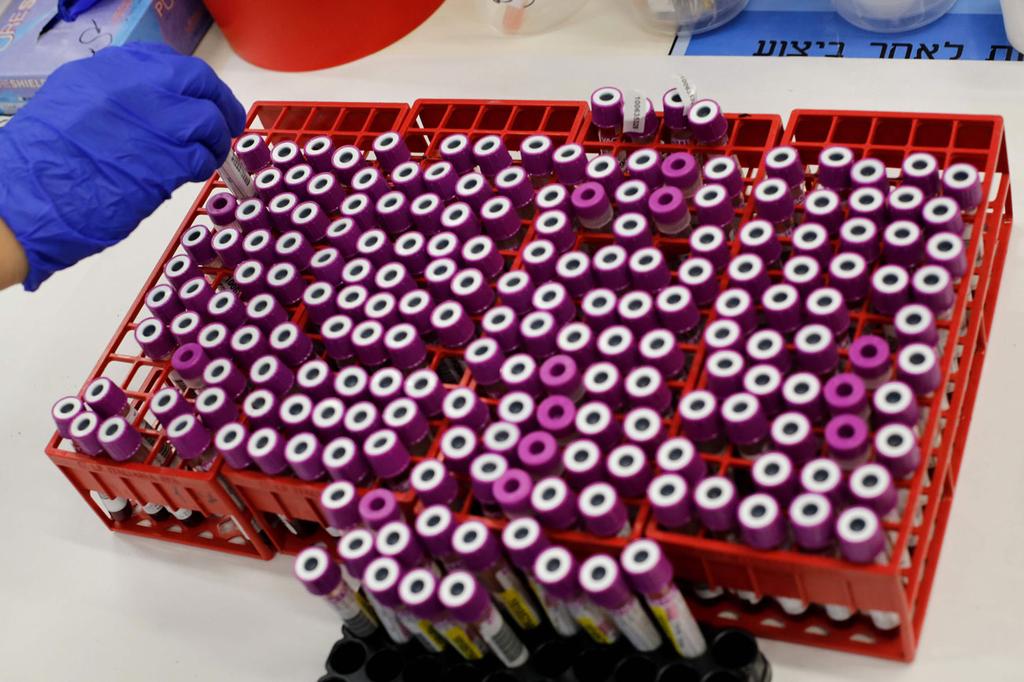 Coronavirus samples (Photo: AFP) Coronavirus samples