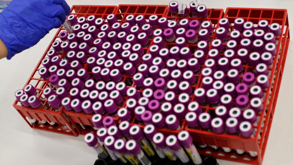  A batch of coronavirus tests at Ashkelon hospital 