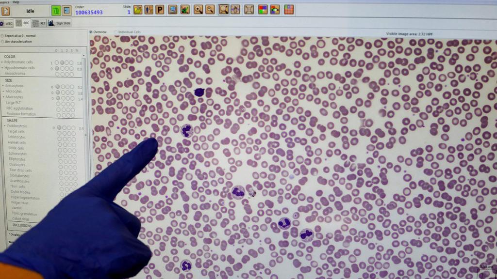 Анализ на коронавирус - больница "Барзилай". Фото: AFP