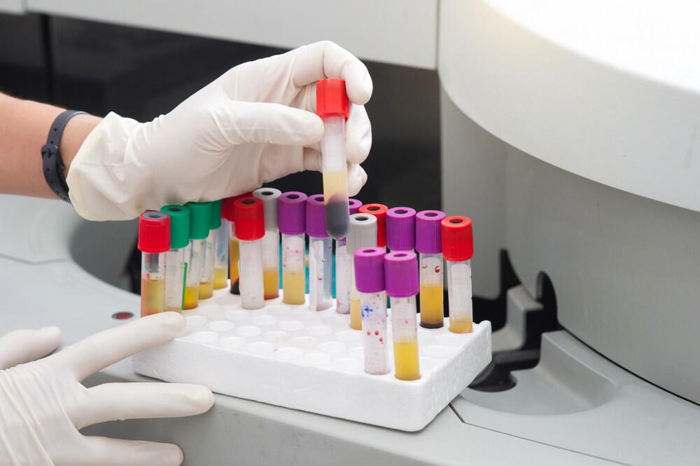 בדיקות דם מחלות מין מעבדה מבחנות 