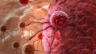 סרטן שד סרטן השד תאים סרטניים