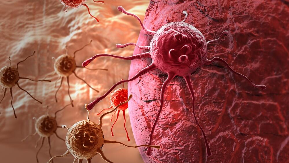 While chemotherapy destroys cancer cells, immunotherapy encourages the immune system to identify and attack the remaining cancer cells (Photo: Shutterstock) סרטן שד סרטן השד תאים סרטניים